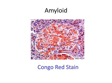 Polarizing Light Microscopy | PPTX
