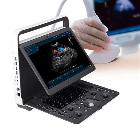 Sonoscape E1exp Digital Color Doppler Ultrasound Machine Sonoscape Medical Ultrasound ...