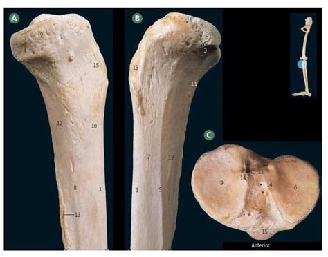 Proximal Tibia 的图像结果