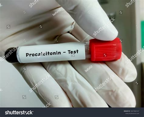 PCT Sample Test 的图像结果