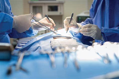 Image result for Angion Method Review