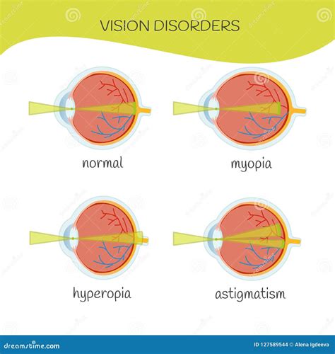 Types of Vision 的图像结果