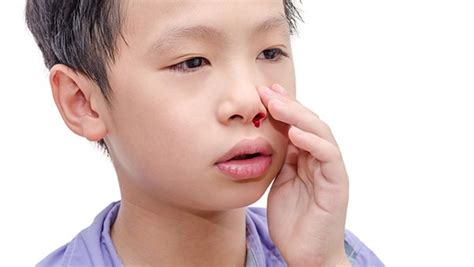 大量流鼻血止不住是什么原因？孩子晚上流鼻血是什么原因引起的？半夜熟睡中流鼻血是什么情况？13种治疗鼻出血的最佳家庭疗法和预防技巧 - 知乎