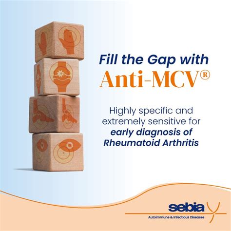 Image result for Sebia Where