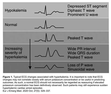 Hyperkalemia Treatment