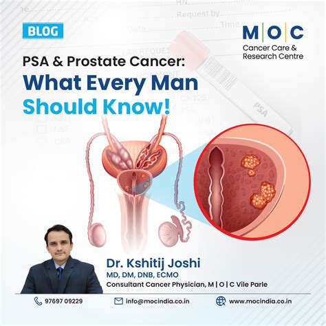 PSA and Prostate Cancer: What Every Man Should Know!