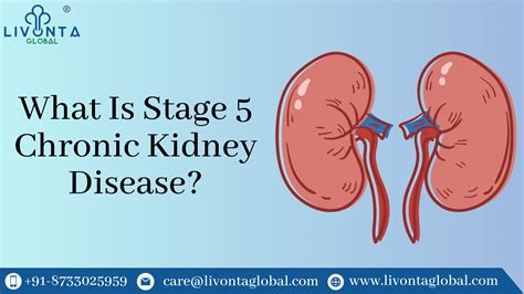 Chronic Kidney Disease Stage 5