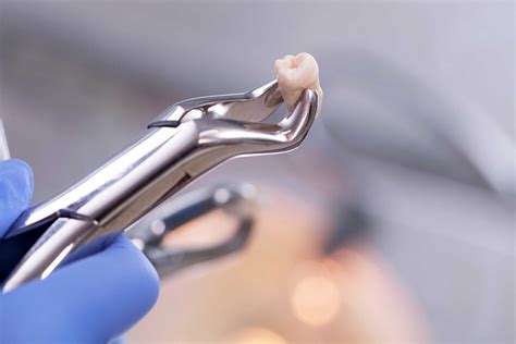 Tooth Extraction Equipment 的图像结果
