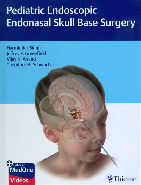 Skull Base Surgery Anatomy Frontiers | Editorial: Endoscopic