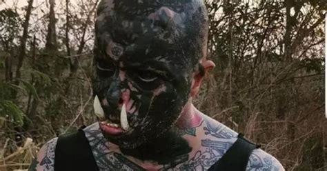 Body Modification Enthusiast Adds Tusks To His Teeth