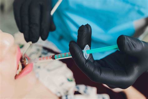 Image result for Wisdom Teeth Removal Procedure