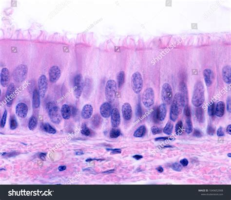 Nonciliated Pseudostratified Columnar Epithelium