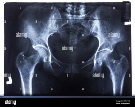 Pelvic Examination High Resolution Stock Photography and Images - Alamy