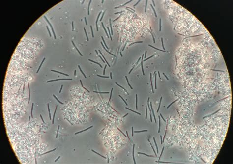 Yogurt Under Microscope