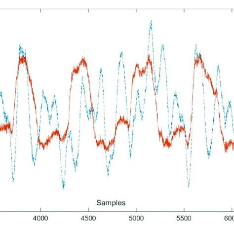 Image result for Pre Conditioned Loop