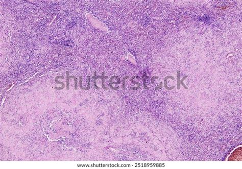 Image result for Tissue Sample Drawing Under Microscope