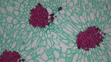 Simple permanent tissue — lesson. Science CBSE, Class 9.