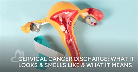 Cervical Cancer Discharge Smell The Interplay Between Human