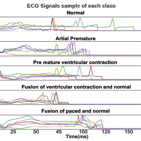 Labels of MIT-BIH Dataset 的图像结果