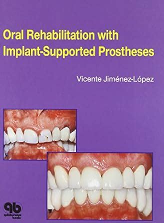 Buy ORAL REHABILITATION WITH IMPLANT SUPPORTED PROSTHESES (HB 1999 ...