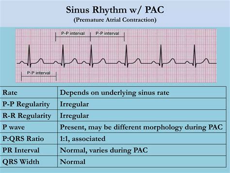 Lec 14 basic ecg interpretation for mohs | PPTX