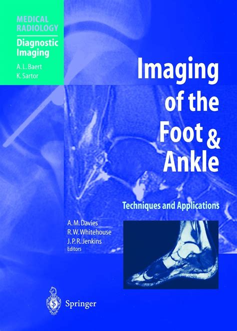 Buy Imaging of the Foot & Ankle: Techniques and Applications (Medical ...