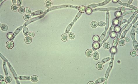 Bildergebnis für candida rauma