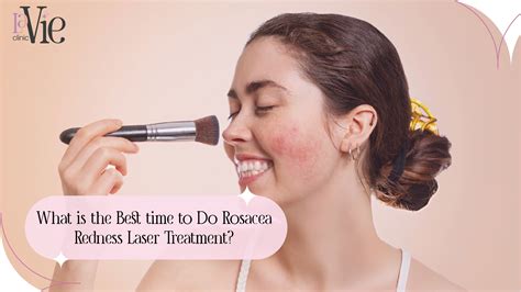 What is the Best Time to Do Rosacea Redness Laser Treatment? - La Vie Med Spa