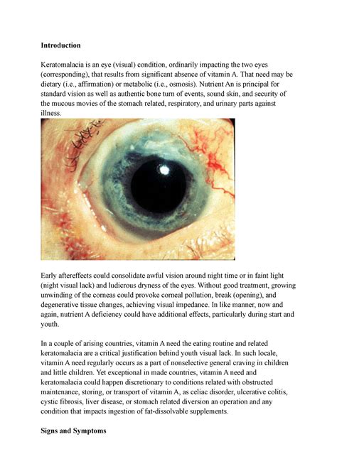 Signs and Symptoms of Keratomalacia - Introduction Keratomalacia is an ...