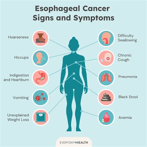 Esophageal Cancer: Symptoms, Causes, Diagnosis, Treatment, and Prevention