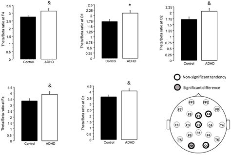 Variations in Theta/Beta Ratio and Cognitive Performance in ...