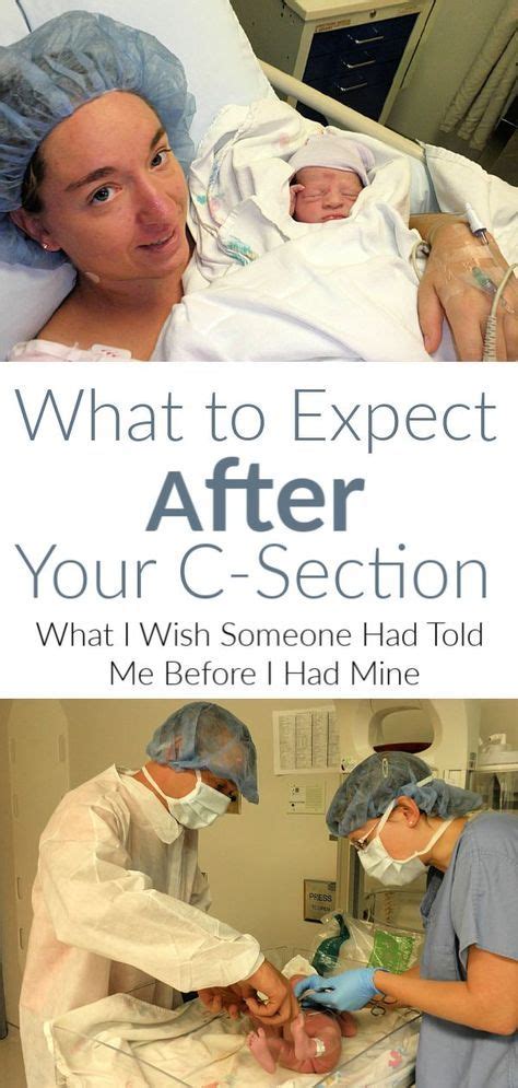 What to Expect After a C-Section | C section, C section recovery, C ...