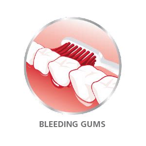 Buy Parodontax Ultra Clean 75g Toothpaste For Daily Protection Against ...