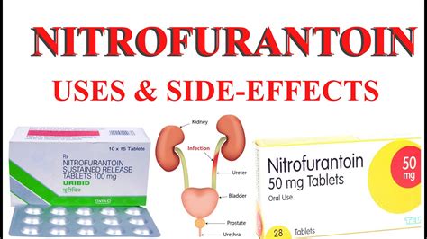 Nitrofurantoin uses/side effects - YouTube