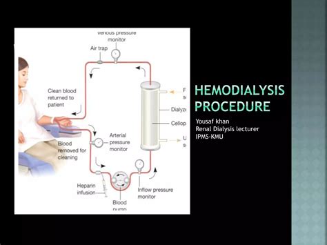 Image result for Dialysis Procedure Step by Step