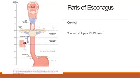 Esophageal motility disorders | PPTX