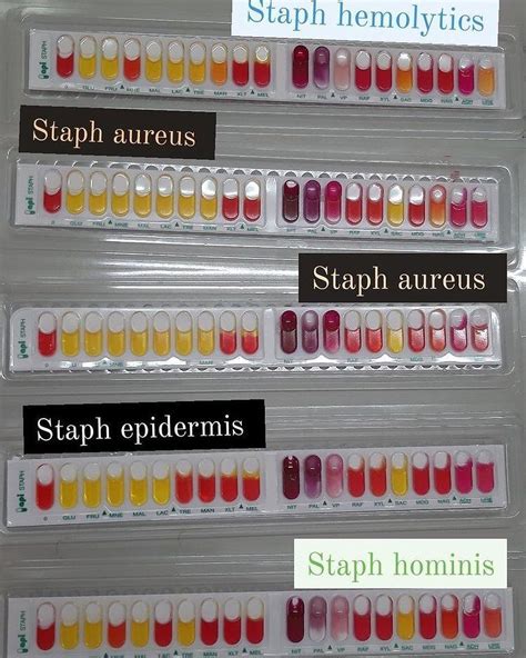 Image result for API NH Test