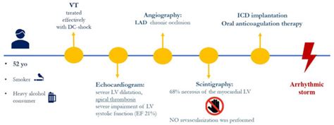 Noninvasive Mapping System for the Stereotactic Radioablation Treatment ...