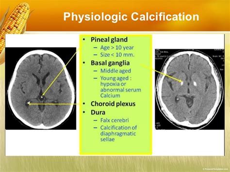 Image result for Thyroid Disorders Algorithm