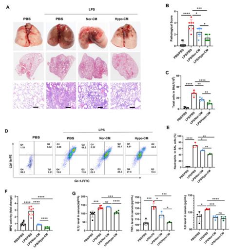 Secretome of Mesenchymal Stem Cells from Consecutive Hypoxic Cultures ...