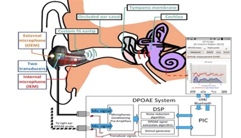 Image result for In-Ear Dynamic Systems Examples