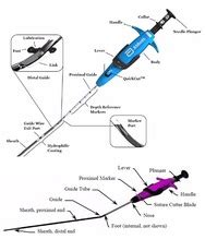 Image result for Perclose Device Tutorial