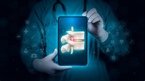 How to Choose a Spine Surgeon | Essential Questions to Ask Your Spine ...