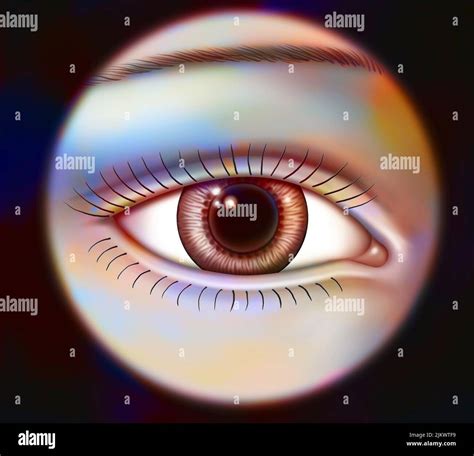 Mydriasis: normal eye with dilated pupil Stock Photo - Alamy