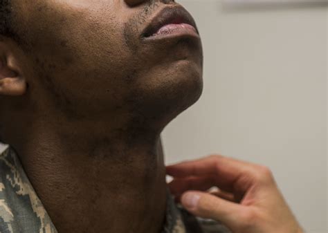 Air Force Surgeon General authorizes 5-year shaving waivers > Air Force ...