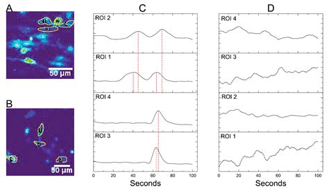 Magnetic-Assisted Cell Alignment within a Magnetic Nanoparticle ...