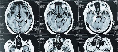 Image result for JJC Programs MRI Programs