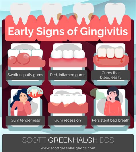 Sign And Symptoms Of Gingivitis