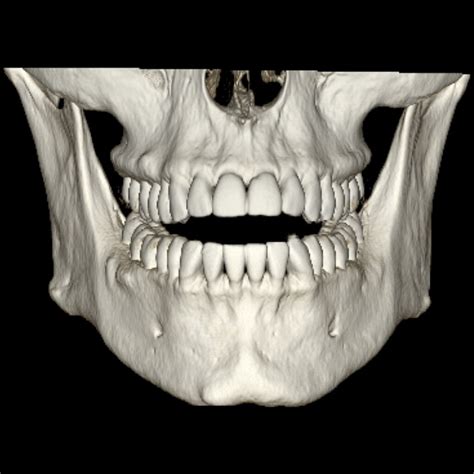 DentaScan | GE Healthcare (India)