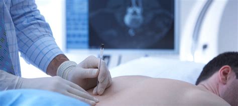 Image result for Interventional Procedure